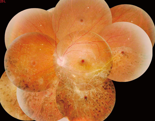 CÁMARA DE FONDO DE OJO CANON NO MIDRIÁTICA , 705*600*300. / MODELO APS-BER